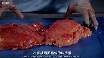 网传女子被解剖吃瓜,一场令人发指的悲剧